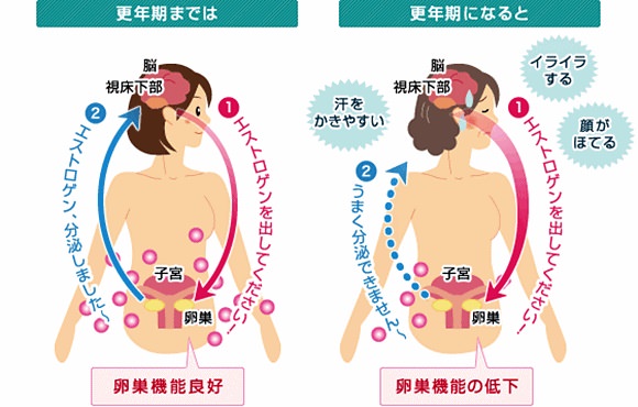 更年期が辛いのはホルモンのせい